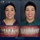 Slider image (9) Soho Dental Clinic – All-on-X & Dental Implant Center